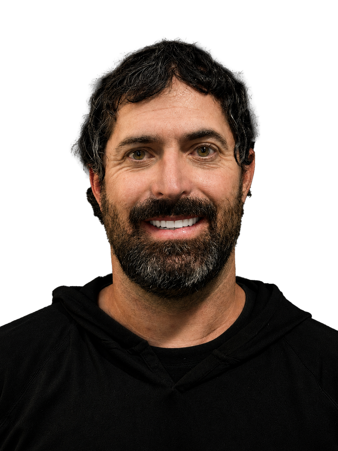 After — Full smile restoration — confidence restored