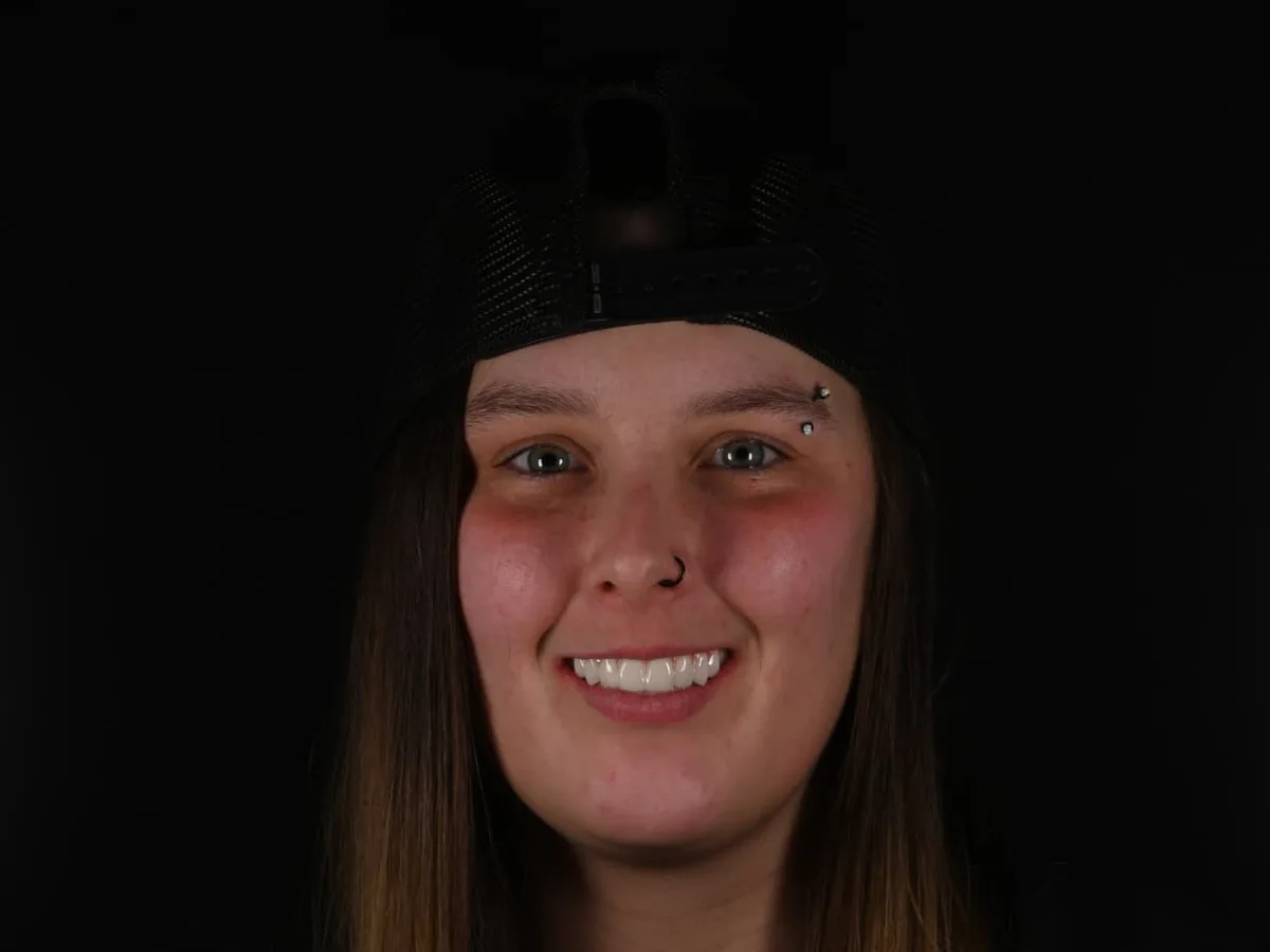 After — A life-changing transformation — bright, natural smile