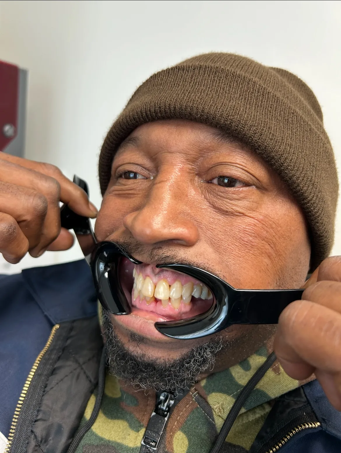 Before — Worn, shifting teeth rebuilt — bright, even smile